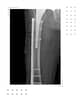Slider image (10) Dr. Rodrigo Aguirre Rojas Orthopedic Surgeon in Mexico
